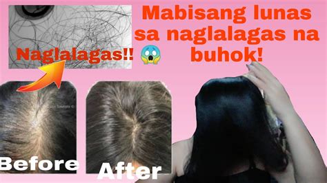 vitamins para sa nalalagas na buhok|HALAMANG GAMOT SA PAGLAGAS NG BUHOK: .